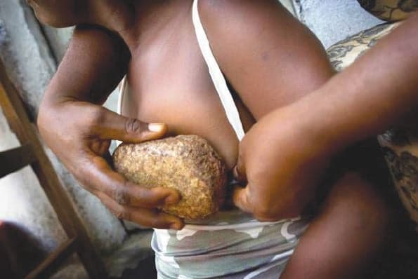 Scarred for life: Untold stories of girls forced into breast ironing (2)